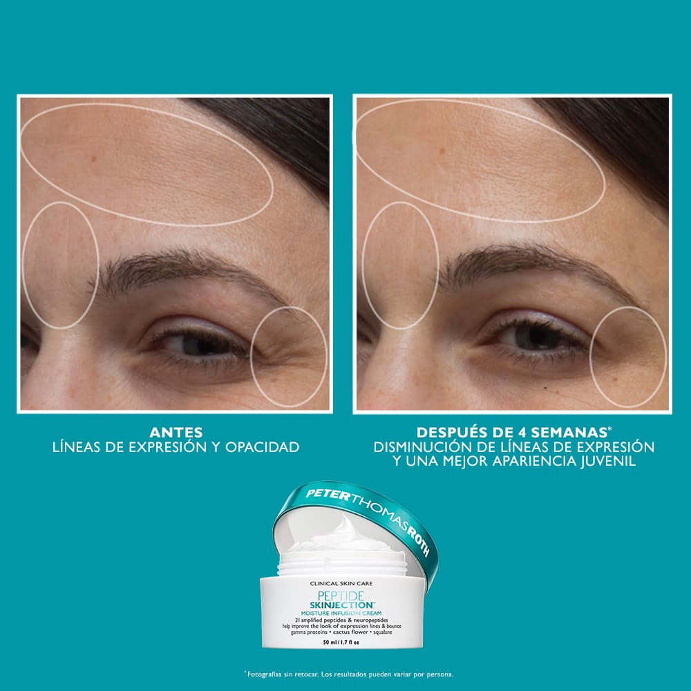 FULL-SIZE PEPTIDE SKINJECTION&trade; 2-PIECE KIT FACE & EYE KIT (SET DE CREMA PARA OJOS Y CARA)